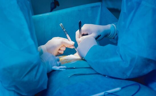 Performing penis enlargement surgery
